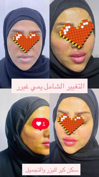فلر شامل • فك وذقن • سكن كير