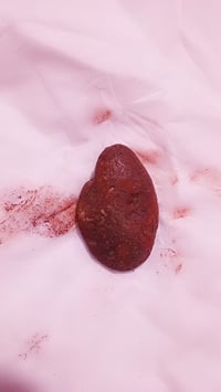 حجر هبهاب • منگول • قديم