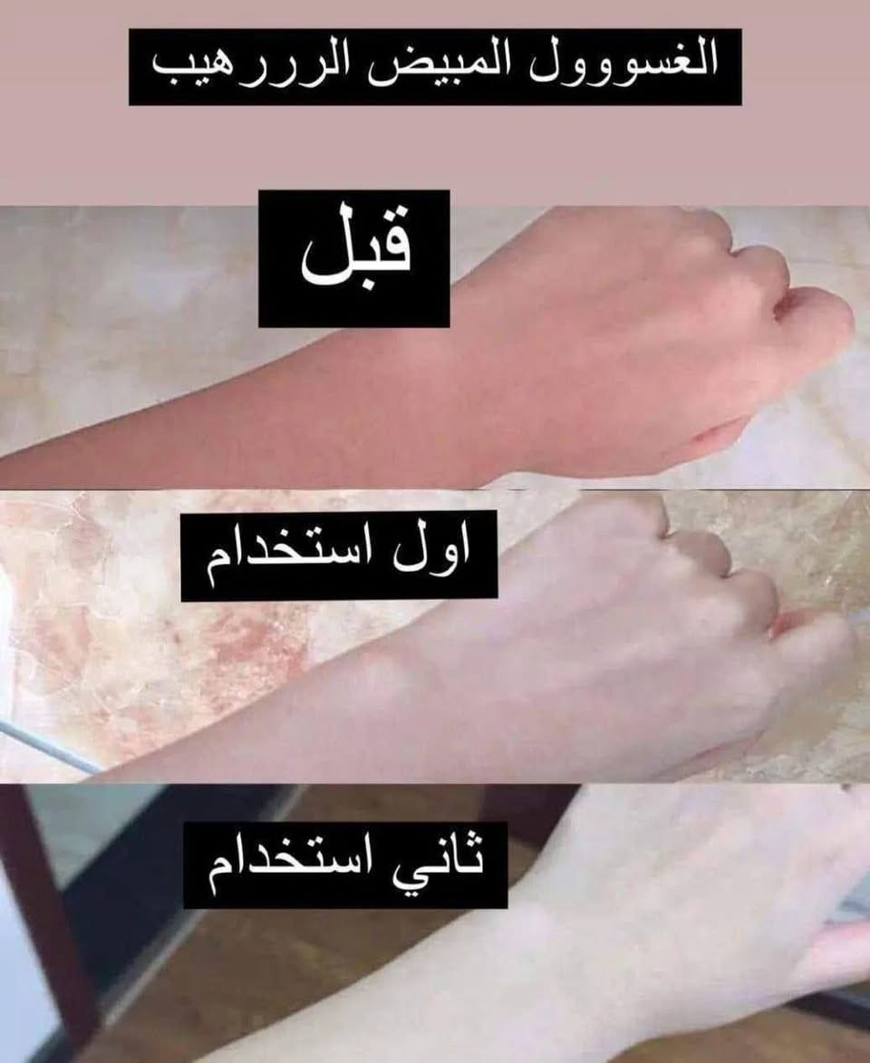 🩵 غسول الاستحمام الطين البركاني 🩵

مكونات الغسول البركاني طبيعية
لتبييض وتنعيم البشرة بشكل موضوح
ومع الاستمرار والاستعمال راح تفتح بشكل دائم 🫣🥰


**إذا كنت صاحب هذا الإعلان وتريد حذفه لأي سبب، رجاءا أرسل رسالة إلى الدعم الفني**