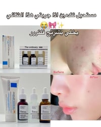 بكج glow skin • كريم سيكا بلاست • سيرومات the ordinary • كريمات بشرة •...