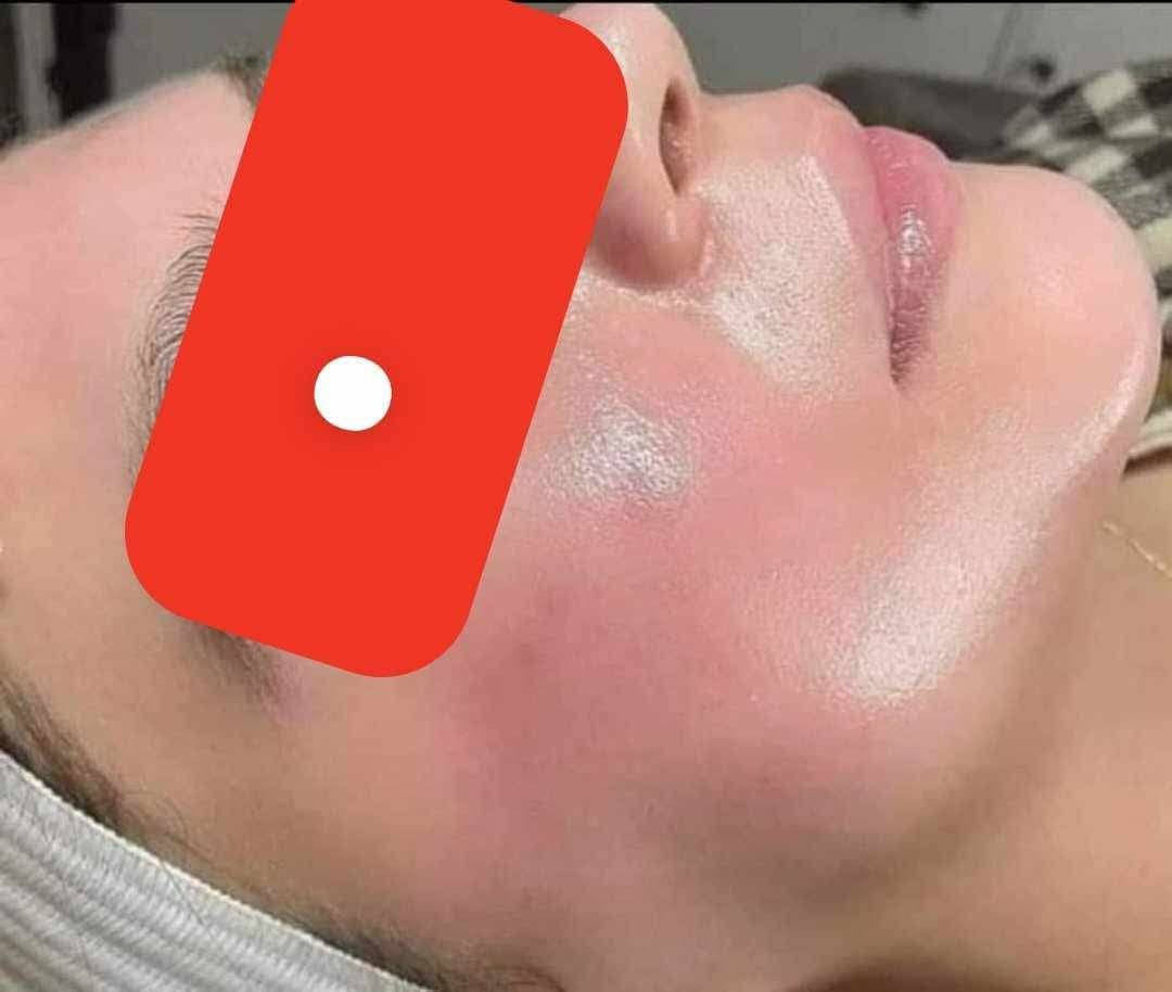 هلاو بناات 🥹🩷 العيد قرّب وماكو وقت نضيّعه، لازم نجهز ونلمع 😁✨ وياكم الكوافيره الأسطوره بشغلها 💖، بصراحة كل تفصيلة عندها تحسسك بالتميّز والفخامة 🥹😍، وأسعارها رهيبه وبالعروض الحلوه الكل رح ينبهر 😍🔥
موجوده داخل مدينه بسمايه، وعرض العيد وياها غيررر 😉 دللي نفسج وما تندمين👀💇‍♀️
العنوان: مجمع A7 📍🌸
أوقات الشغل: 10 صباحاً – 4 مساءً | 8 مساءً – 10 مساءً
للحجز: واتساب *********** أو على صفحة كوافيرة بسمايه مشو بيوتي  💕
@الجميع
