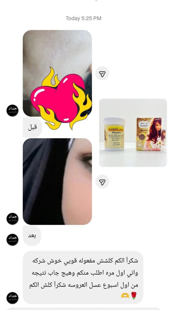 عسل_العروسه مسمن وجة 🤭💗
✨ عسل مسمن العروسة الاصلي مبيض ومسمن للوجه :
▪︎غني بالفيتامينات والمكملات الغذائية . 
▪︎هذا المنتج مصادق عليه طبياً .. 
▪︎يعمل على تسمين الوجـة 🎗
▪︎ ويجعل البشره اكثر نظاره وتألقاً .
#للحجز_والاستفسار_مراسلة_خاص. 
#مسمن_للوجة #عررض_لفترة_محدودة +هدية.


**إذا كنت صاحب هذا الإعلان وتريد حذفه لأي سبب، رجاءا أرسل رسالة إلى الدعم الفني**