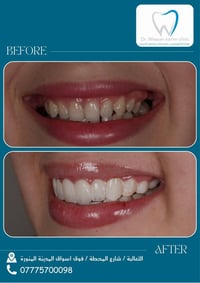 عيادة اسنان • تجميل اسنان • بغداد الثعالبة