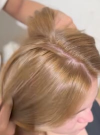 حواجب • شوارب • هايدروفيشل