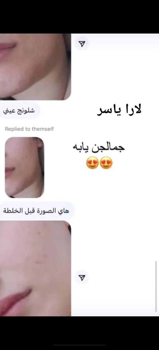 الحمد الله على نتائج كريم لارا ياسر
فديت كيكاتي احبكم 😘😘😘


**إذا كنت صاحب هذا الإعلان وتريد حذفه لأي سبب، رجاءا أرسل رسالة إلى الدعم الفني**