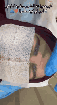 تعبتي من تاتو الحاجب وشكله كل يوم يضايقج ؟
لا لون ثابت ولا رسمه عاجبتج؟
زراعة الحاجب بتقنية المايكرو هي الحل الصح،
ترجع ترسّم الحاجب شعرة شعرة وبشكل طبيعي يليق بملامحج
والنتيجة تبين من نفس اليوم بدون انتظار ✨
لأن الجمال الحقيقي ما يحتاج تصليح كل فترة، يحتاج قرار صح �
للتواصل والاستفسار
***********
