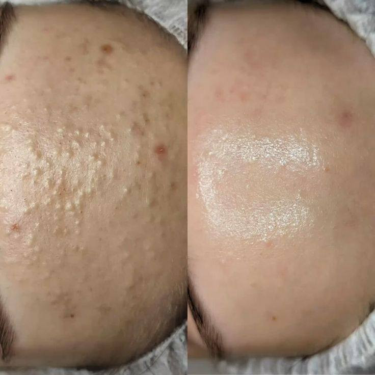 ‏🌸  اللهم صلِّ على محمد وآل محمد كما صليت على إبراهيم وآل إبراهيم 🤍
‏✨ عروض صالون الإمبراطوره – يناير 2026 ✨
‏💆‍♀️ حفافة وجه مع تنظيف بشرة عميق (هيدروفشيال)
‏💰 20,000 د.ع بدل 40,000 د.ع
‏🌸 حفافة حاجب + صبغ حاجب يدوم شهر
‏💰 6,000 د.ع
‏👑 دللي نفسچ مثل الإمبراطوره لانج تستاهلين 🤍
‏📍 العرض لفترة محدودة طوال شهر يناير
‏📞 للحجز والاستفسار: [ ‪+9647756066151‬
‏    ‪***********‬     ]
‏📍 كربلاء المقدسة، حي الحر، مقابل مجمع ليمونه 2 – صالون الامبراطوره
‏
