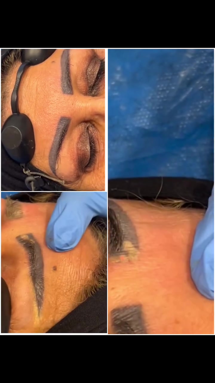 #عرض_خاص 
@ڪل 3 جلسات 125 الف 

#جهاز_الفي_ليزر  pHI LAser
الجهاز الاحدث عالمياً والاول  بالشرق الاوسط
من أقوى انواع الليزر .. يزيل التاتو الغامق و الفاتح  والوشم بڪل انواعها 

دائما نحب نوفرلكم الافضل ✅✅
للحصول على افضل النتائج ✅✅✅💎💎💎

لازالة التاتو والوشم بعدد جلسات اقل ونتائج مضمونه ✅✅

يعمل جهاز الفي ليزر ع استهداف صبغة التاتو فقط💎💎💎

من دون الحروق او تلف للجلد بل يعمل ع تحفيز الشعر وترميم  الجلد✅✅✅

🔘 
‏مـــــــــع رينا لليزر والتجميل 
🔻
⛳️ العنوان / داخل مجمع علم الكندي الطبي التخصصي/ قريب من البوابة الجديدة/ قريب من أسواق زاد الخير 
        
📲 للحجز والاستفسار 
***********
( متوفر واتساب )
