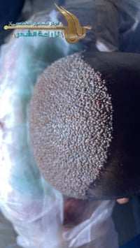 نفس اليوم… وبعد ما خلصنا العمليات مباشرة شوفوا الكثافة شلون مرتبة وواض...