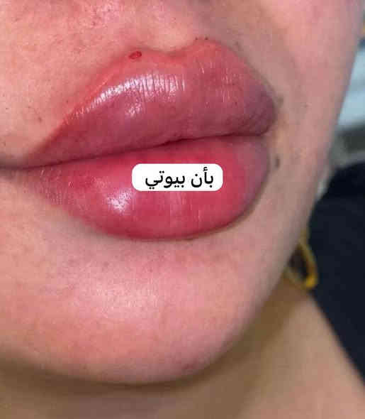 بان بيوتي.. واحد من أفضل وأرقى الصالونات الموجودة بمدينة الغزالية بعمل أحترافي لا يشبه البقيه 😍🧡

اليوم مسويه عروض رنانه ومفلسه الأسعار للأخير بالنسبة للتجميل والفلر والأصباغ وكل شئ وصورة العروض مُرفقه مع الصور وصاحبة المركز تكول أريد بنات ونساء الغزالية كلها تجي على هالأسعار 🥹

 بان بيوتي :- الغزالية - شارع المركز - مجاور مدرسه اجيال النور الاهليه وحور كوزمتك 📍

هاتفهم:-
***********
