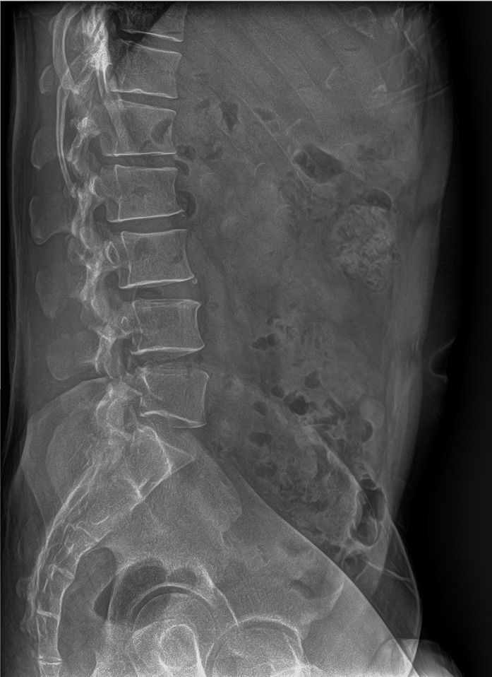 🏥✨ مكتب الجوهرة للأجهزة الطبية ✨🏥

📢 متوفر لدينا الآن

🔹 مستقبل الأشعة الرقمي (DR Detector)
🔹 نوع SHOW IMAGE
🔹 أجهزة جديدة بالكامل (غير مستعملة)

⭐ المواصفات والمزايا:
✅ Wireless – اتصال لاسلكي كامل
✅ AED (Automatic Exposure Detection) – الكشف التلقائي عن التعريض
✅ مقاس 17 × 17 إنش
✅ مقاوم للماء والغبار بمعيار IP65
✅ سرعة عالية في نقل واستقبال الصور
✅ جودة تصوير استثنائية ودقة تشخيصية عالية
✅ متوافق مع مختلف أنظمة الأشعة الرقمية

🏅 شهادات الجودة العالمية:
✔ FDA Certification
✔ CE Certification
✔ ISO Certification

📦 المحتويات:
• Flat Panel Detector
• Access Point
• Adapter + Charger + بطارية اضافية
• جميع الكيبلات والملحقات الأصلية
• برنامج تشغيل متكامل

🛡 ضمان حقيقي لمدة 3 سنوات
🚚 الشحن والتركيب والتدريب متوفر
🛠 دعم فني وخدمة ما بعد البيع

📞 للتواصل والاستفسار:
0770 285 5535

0770 347 4472

0771 172 9698

📍 مكتب الجوهرة للأجهزة الطبية
ثقتكم مصدر نجاحنا
