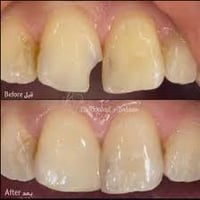 الي عنده مثل هاي الحالات ويريد علاجهم يتواصل ويايه ع هلرقم 07742482411...