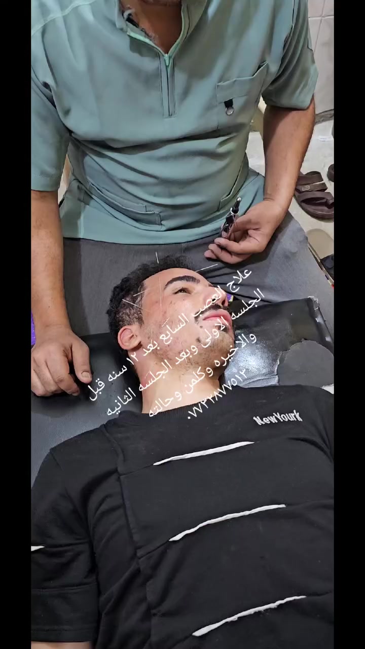 علاج العصب السابع الشرجي اخوكم المعالج المتخصص ماهر اموري السعدي العنوان كربلاء قضاء طويريج قرب مرقد ابو هاشم ابن الحمزه تابعو الصفحه وكلشي موجود ***********
