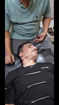 علاج العصب السابع • ماهر اموري السعدي • طويريج كربلاء