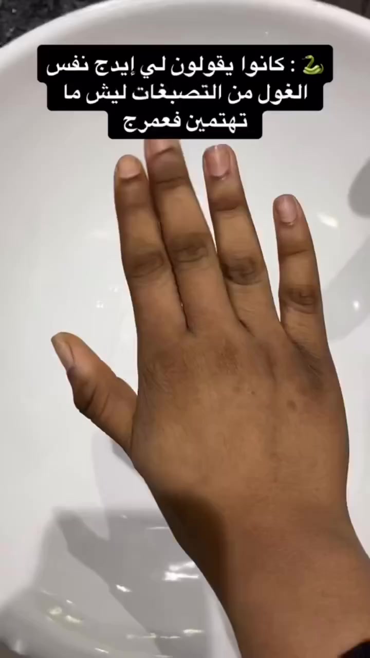 ﴿ وهج بغداد﴾
في متجر وهج بغداد يوفر متجر ‏" 💛 مميزات kenta كريم

يناسب لجميع أنواع البشرة.
يمكن استخدامه للبالغين والأطفال.
لا يحتوي على الكورتيزون.
فوائد كريم كينتا المغربي

يفتح البشرة ويقلل الاسمرار والمناطق الغامقة في الإبطين والركبتين والمنطقة الحساسة.
يرطب البشرة وينعمها ويحسن ملمسها.
له نتيجة فعالة في تفتيح المناطق الداكنة بالجسم لدى الكبار، المناطق الحساسة والكوع والركبتين.

#الاصلي 💯

السعر ١٦ الاف مع توصيل مجاني الكل محافظات


**إذا كنت صاحب هذا الإعلان وتريد حذفه لأي سبب، رجاءا أرسل رسالة إلى الدعم الفني**