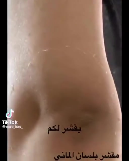 مقشر بلسان Balsan
( التقشير الكيمياوي للجسم ) الالماني 🇩🇪🇩🇪الاصلي💯 ✅

اقوى مقشر ومفتح اماكن غامقة يعمل على ازالة الجد المتثخن والاسمرار الحاصل في الرقبة والركب والايدي والكوع والارجل .. وازالة الجلد الميت ويعتبر افضل علاج للاقدام المتششقه نتائج سريعة جداً جدأ. 💯✅

لتفتيح مناطق الكوع وباقي اجزاء الجسم الي تعاني من سواد مزعج 

بنات هذا المقشر راح ايعالج اي منطقه خشنه او يابسه او بيها سواد قوي وصعب علاجه منتج الماني اصلي 💯💯💞

طريقة استعمال مقشر بيلسان 👇👇

1. لازم اتكون البشره الي انريد نستعمل عليها المقشر ان تكون يابسه ومو رطبه
2. لازم تكون المنطقه غير حساسه🌸
3. اول شي انجيب قطن مكياج  تكون طبقه خفيفه انخليها عل منطقه 
4. انخلي البيلسان عل قطنه كميه تكون القطنه  كلش رطبه💧
5. انغطي المنطقه  ب كيس حتى نحصل على ترطيب اكثر للمنطقه
6. بعد 30 دقيقه تفتحون  الكيس وتوخرون القطن وجيبون اي شفره   اتقشرون بيها .

المنشأ الماني 🇩🇪💯💯
احذروا التقليد 🚫 
انتباه الاصلي الاصلي يمنا هوايه موجود التقليد بالبيجات باسعار جدا مناسبه لكن مو اصلي الي عدنه الماني الاصلي 🇩🇪💯💯
اذا مو اصلي ومو نفس نتائج الفيديو نرجعه.  
السعر ال٥٠ مل ١٤ الاف 
🚘 يوجد خدمة توصيل لجميع محافظات العراق


**إذا كنت صاحب هذا الإعلان وتريد حذفه لأي سبب، رجاءا أرسل رسالة إلى الدعم الفني**