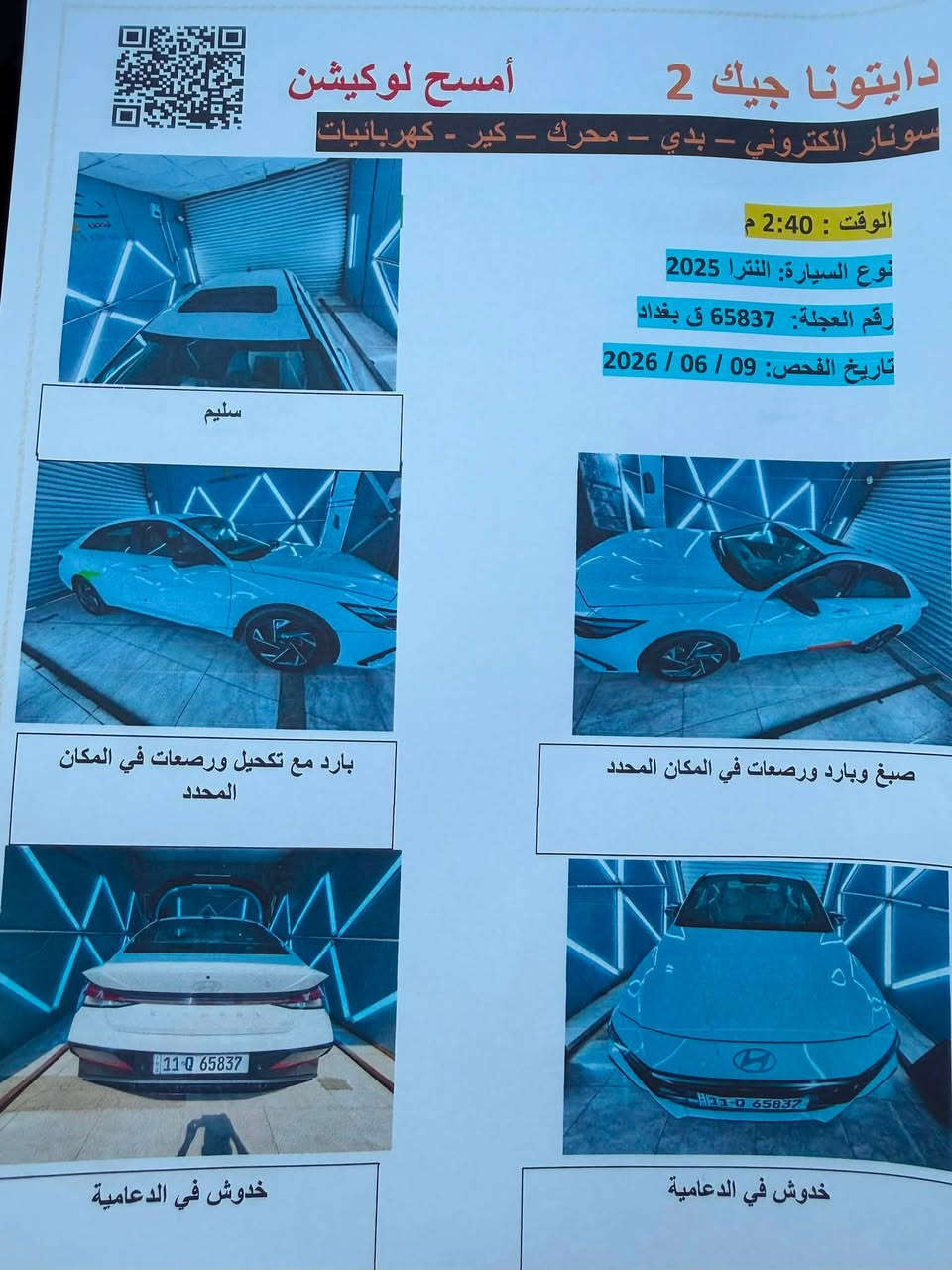 السلام عليكم.. النترا خليجي 2025 كوري فول مواصفات مكينة 2.0 الممشى 44 الف كم السيارة بعدها داخل الضمان دهن فلاتر كلهن بالشركة 

مواصفات السيارة فتحة سقف وبصمة وتشغيل عن بعد حساسات امامية خلفية كاميرا خلفية نظام ترحيب مرايا شفط صندوك ذكي فتح عند الاقتراب شاشة Android Auto و Apple Carplay 
4 وضعيات قيادة  Smart - Normal - Eco - Sport
تحكم كامل بالمقود(ستيرن) شاحن لاسلكي عدادات ديجتال كاملة وبعد بيها هواية مواصفات 
بيها بس ملاحظتين موجود سونارها بالمنشور 
السيارة نظيفة استخدام شخصي اني طلعتها زيرو من الشركة وبأسمي 
سعرها 18.300 وبيها مجال.
📞 ***********
