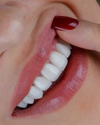 “ما كنت أتوقع يوم من الأيام أبتسم بهالثقة 😭✨ تجربتي مع طبيبه الأسنان ز...