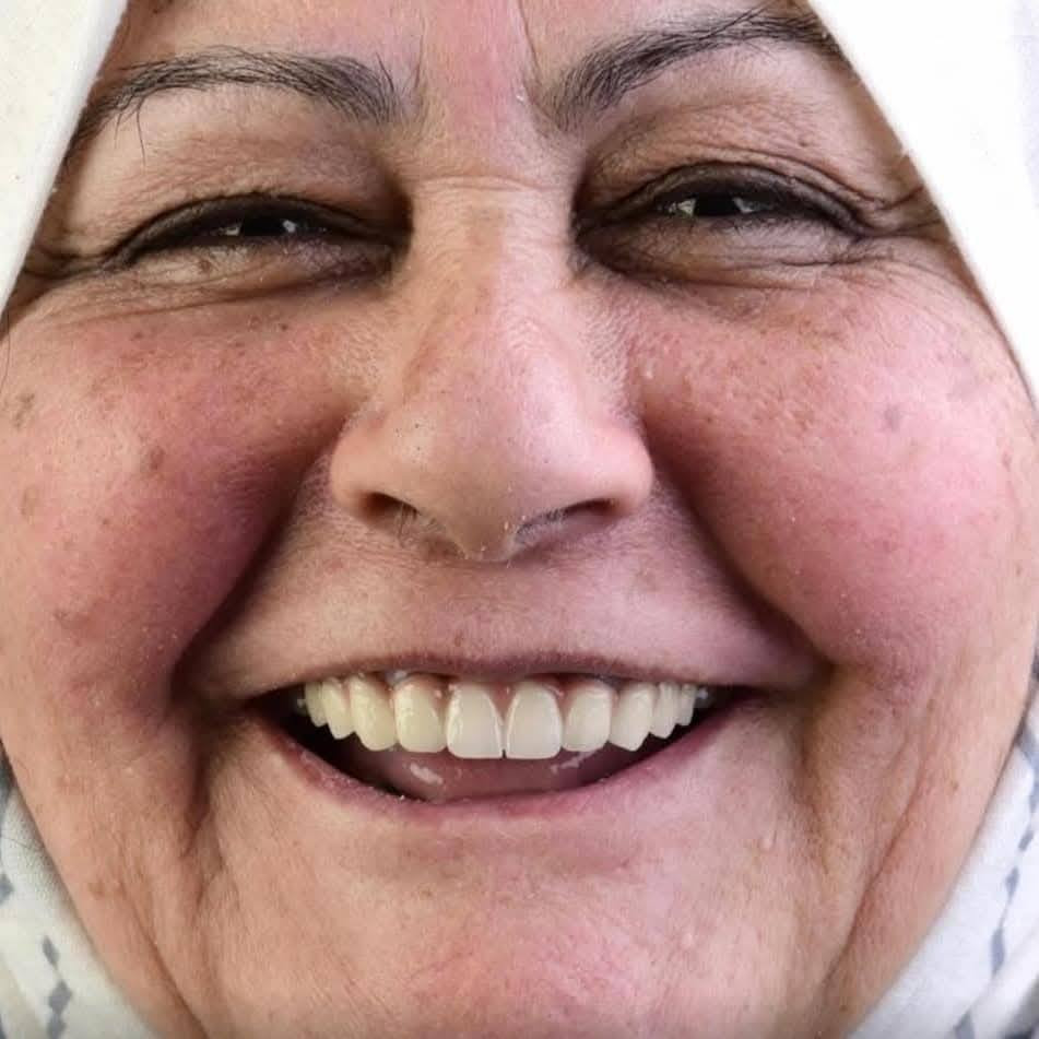 المختبر الفني السوري  لصناعة الاسنان
و التعويضات السنية وتركيب الأسنان
وبأنسب الاسعار بجميع المحافظات
العراقية 
ملاحظة لدينا كادر يزور المريض للبيت ويتم العمل في المنزل 
 للتواصل. ***********
