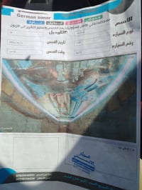هيونداي النترا 2014 • النترا خليجي • النترا رقم أربيل • سيارة النترا 2...