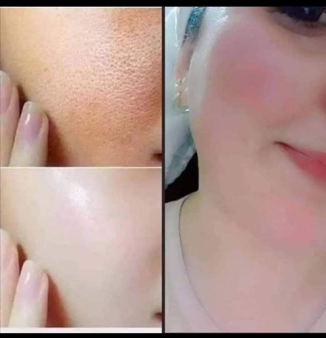 سويت الكم  خلطه اسوي الوجه كيمر والخدود ورديه وعن تجارب زبائن وكل لجربهة رجع طلب منهة خلطه اصليه وشغل ايدي يعني مابيهة لا عصاصير ولا اي مواد كيميائيه خلطه فقط فيتامينات وكولاجين  الوجه وتشد البشرة وتعالج كلف ونمش وحب الشباب وبعد حته متحتاجين تحطين مكياج الخلطه تنفع الشباب ايضا هاي لخلطه معالج كامل للبشرة ونتائجها دائميه بنات  اني اسويهة بيدي وعلي كل الضمان بيهة تجنن والتاخذ والله متندم ابد وياها صابونة العنبر
🦋متوفر توصيل داخل سوق الشيوخ والناصريه مركز 🦋


**إذا كنت صاحب هذا الإعلان وتريد حذفه لأي سبب، رجاءا أرسل رسالة إلى الدعم الفني**