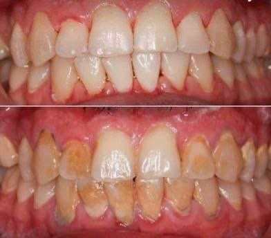 السلام عليكم الي محتاج 
حشوه 
قلع 
تركيب اسنان 
تنضيف 
نشتغل اله بالجامعه تحت اشراف اطباء اختصاص علما ان العمل مجاني 
هذا رقمي بي واتساب الي يحتاج شي يراسلني 
***********
