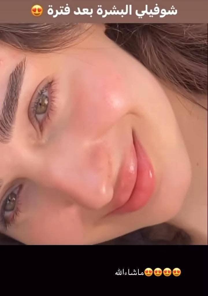 🎉🔥 عرض العيد من ليان بيوتي 🔥🎉
بمناسبة العيد حبايبي 💕
كل البكجات ✨ التركيبات ✨ وكل المنتجات
بس بـ 20 ألف وبس 😍
🚚 التوصيل 3 آلاف لكل المحافظات
لا تفوتج الفرصة 💄✨
جددي بشرتج وشعرج قبل العيد وخلي طلتج غير 💖
العرض لفترة محدودة… احجزي هسه قبل لا يخلص 🔥


**إذا كنت صاحب هذا الإعلان وتريد حذفه لأي سبب، رجاءا أرسل رسالة إلى الدعم الفني**