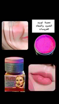 مورد خدود • مورد شفايف • ثابت طول اليوم