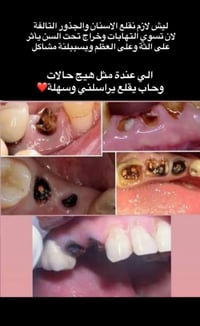 المكان جامعه اشور /شارع مطار المثنى واتساب 07747911490