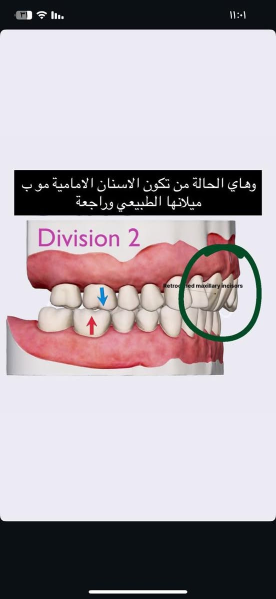 للاطفال من بعمر 9 او 10 الي عندهم مثل الحاله الي بالصورة تقويم مجاني بالبصرة والزبير للتوصل ***********
