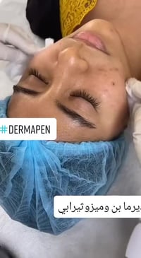 ديرمابن اينزو • اصلي ايطالي • امبولة ميزو وايت