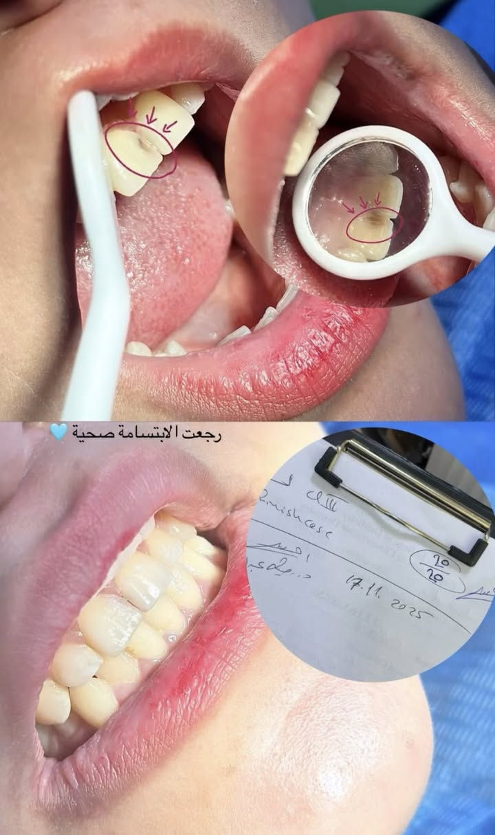 تنظيف وتلميع الاسنان ازاله التكلسات والتصبغات
قلع الجذور التالفه التسبب رائحه كريهه و التهابات في الفم  
قلع المتحركه اللبنية والدائمية
حشو الاسنان بالحشوات الضوئيه والتجميليه
المراسله خاص او على الرقم ***********
الكراده شارع ٥٢
