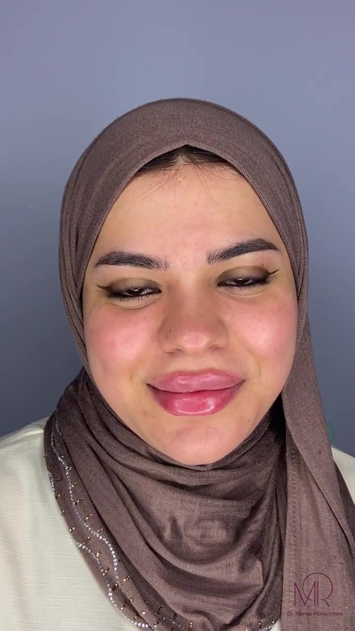 فلر شفه للجميلة 🌸👄

عيادة الدكتورة مروة محمد التميمي

🏥الديوانية العروبة-شارع المتحف-مجاور مطعم كودو كودو
📞رقم الحجز ***********

متوفر نظام التقسيط على الماستر كارد
