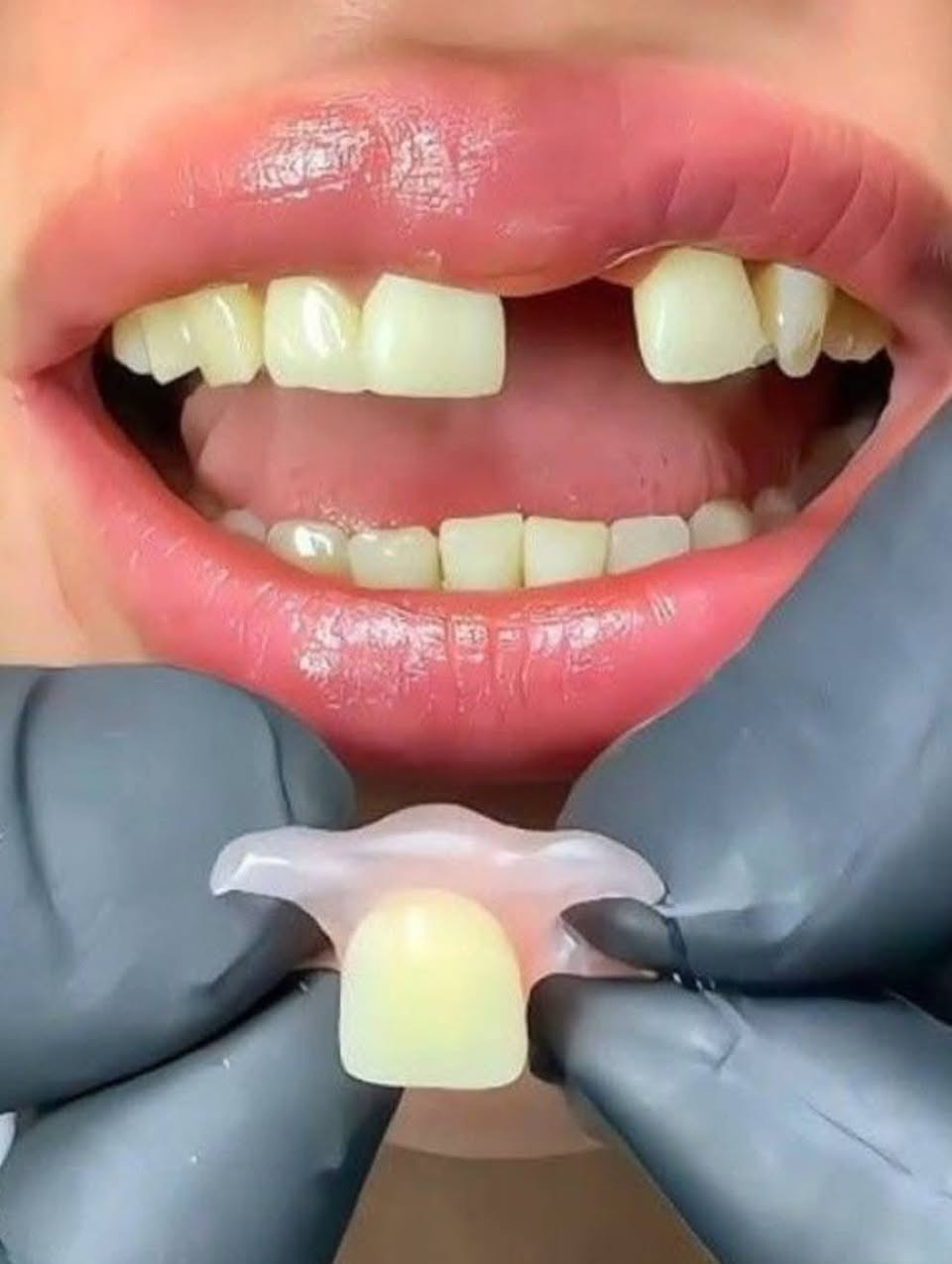 الي محتاج حشوه للاسنان للحالات الي موجوده بالصور أو تعويض الاسنان بطقم جزئي متحرك
او قلع الاسنان التالفه 
علما بان العلاج مجاني وتحت إشراف كادر طبي مختص 
العنوان جامعه الوطنيه مجاور ملعب التضحيه 
***********
