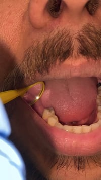 مجانا يتوفر قلع جذور الاسنان واسنان متحركة واستبدالها بطقم متحرك تواصل...