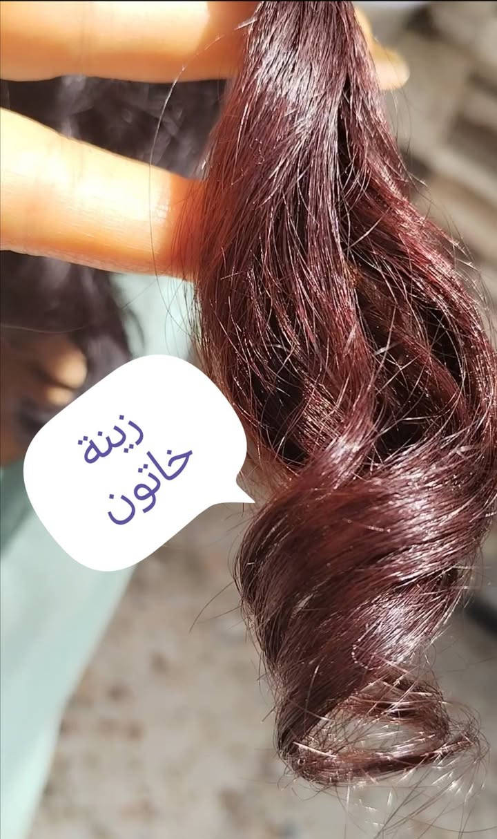 الدنيا احترت، وعطلة، والشعر يحتاج تغذية، وفروة الرأس تريد تتخلص من الحرارة، حتى تتنشط الدورة الدموية وتتقوى بصيلات الشعر، لازم تستخدمون حنة زينة خاتون 👸🏻،،، وجايكم العيد،،  بالنسبة للحنة ممتازة لفروة الرأس الشعر، للمعة وكثافة وطول وشعر صحي خالي من التساقط والتقصف والخشونه والتشابك 😍😍😍  راح تشوفين الفرق من أول استخدام وهذا 👇 جزء من نتائج الزبائن 😎😎


**إذا كنت صاحب هذا الإعلان وتريد حذفه لأي سبب، رجاءا أرسل رسالة إلى الدعم الفني**