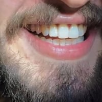 تنظيف اسنان مجاني • د محمد صادق • الحله شارع 40