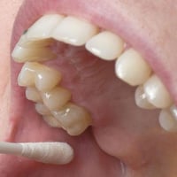 الي فاقد اسنان مثل الي بالصورة ويحب نعوضلة اسنان يتواصل وياي  07844724...