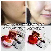 كريم التنين • سيرومات The Ordinary • توصيل مجاني