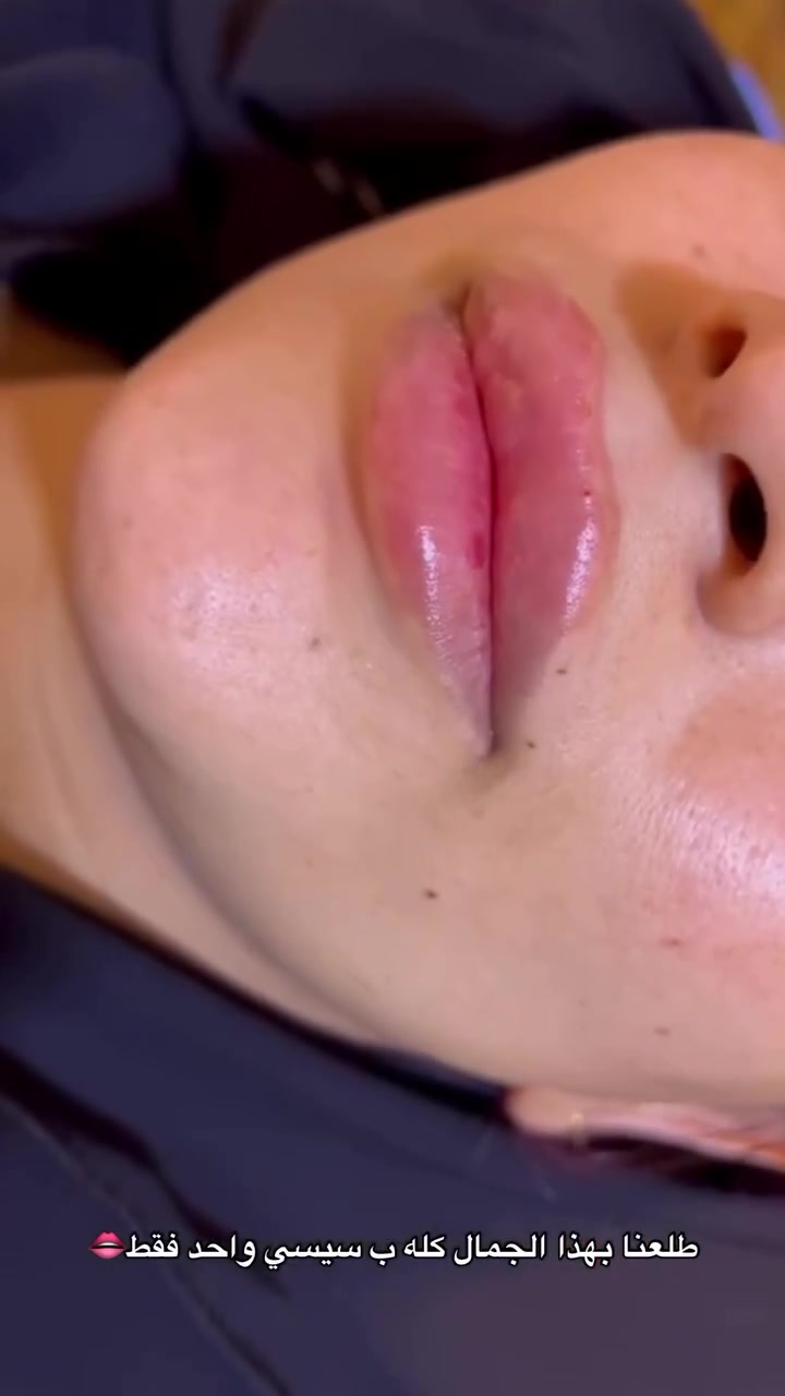 مرحباً بنات حبيباتي جبتلكم احلى وألطف دكتورة تجميل وعن تجربه ضيفوها وروحوا اشتغلو يمها ايده خفيفه واستغلوا العروض  الفلر ب٦٥ الكوري 
الفرنسي ٩٥
والإيطالي ١٢٥ مكانه بجسر ديالى بعمارة الربيعي وهذا رقم الحجز ***********
