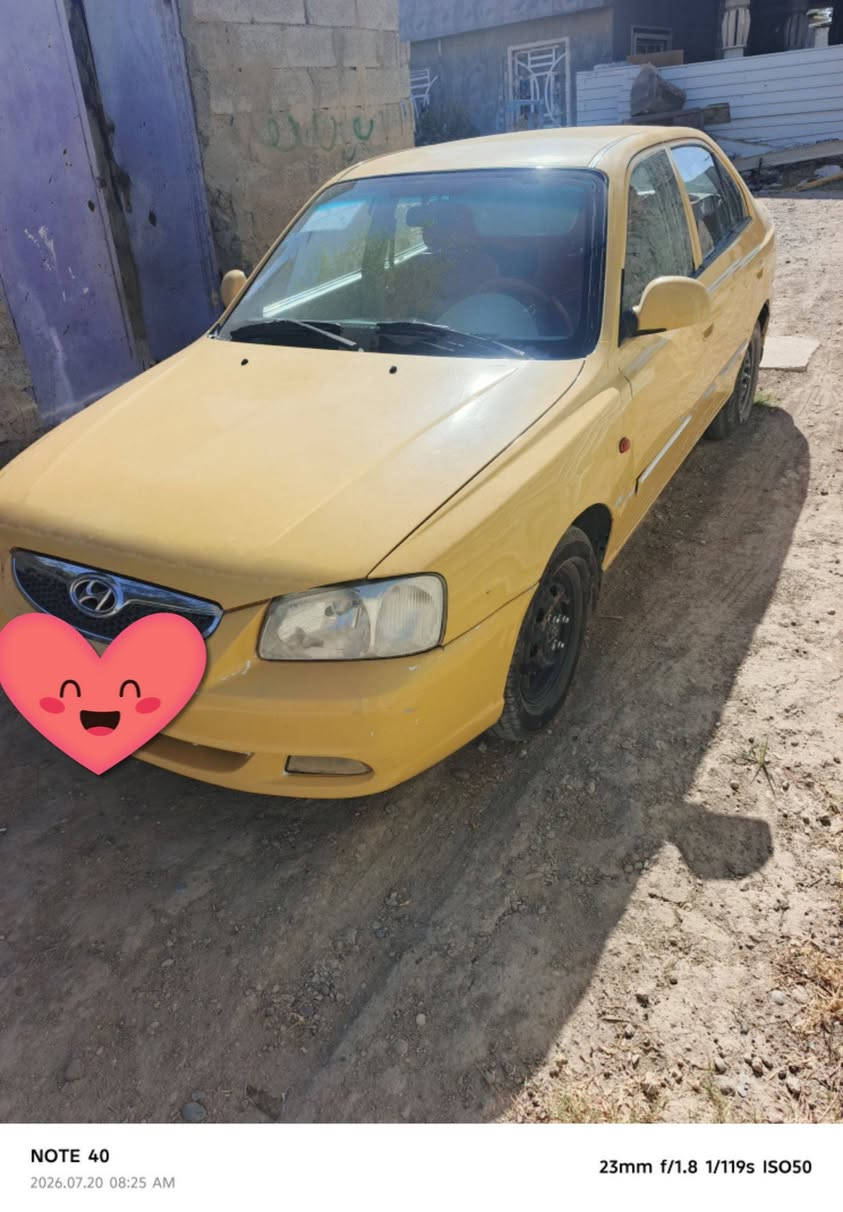 السلام عليكم
يوجد سياره للبيع فيرنا موديل ٢٠١٤ مكفوله گير ومحرك للاستفسار الاتصال بالرقم ***********
