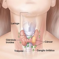 🧪 فحص Thyroglobulin (TG) متابعة دقيقة لصحة الغدة الدرقية 🔬 ما هو فحص T...