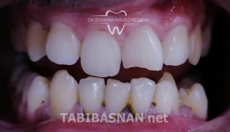 مجانا مجانا 
العنده مثل هيج حالات متوفر حشوات وقلع 
غدا بجامعة واسط
للحجز المراسلة ع الخاص او الاتصال بالرقم ‭

‭٠٧٧٤ ٨٢٠ ٢٨١٢‬
