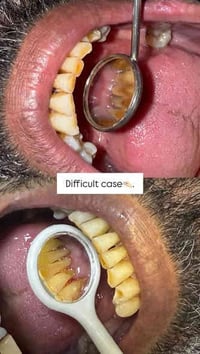 📣السلام عليكم  الي محتاج تنظيف لاسنانه موعد العيادة باچر ساعه 12:00 كر...