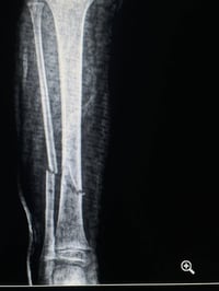 د. أحمد الطيار • جراحة عظام • مجمع الزاب