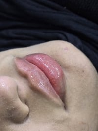 فلر شفه • توله فروش • صيدلية مازن