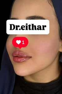 استداره وجه • تعديل شفه بدون تذويب • الكوت واسط