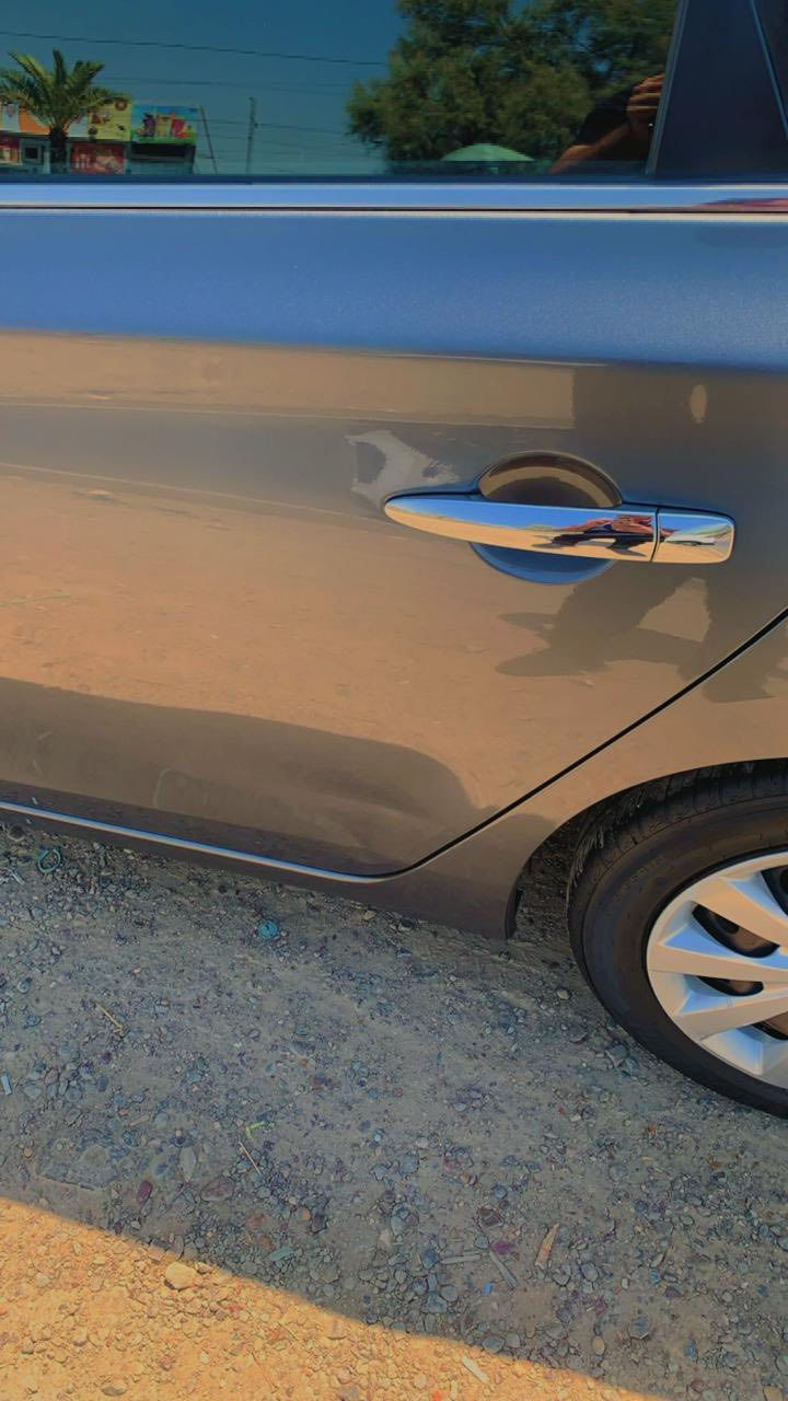 السلام عليكم سنترا 2017 للبيع وهاي صور الحادث والتفاصيل والسعر 120 وبيها مجال  ***********
