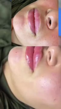 فلر شفه • تجميل • حي ١٧