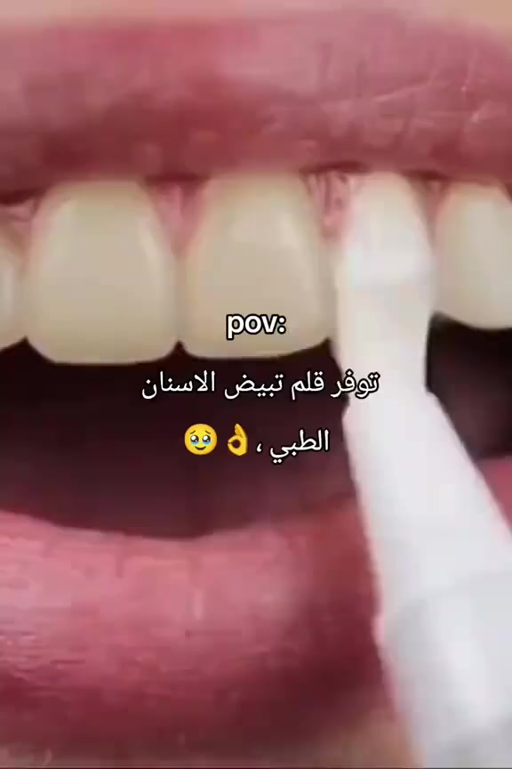 هذا القلم يستخدم لتبييض الأسنان بطريقة سهلة وآمنة، نتيجته تبين من أول استعمال بإذن الله!
💙 منتج أصلي من ماركة medcodes، يحتوي على تركيبة فعّالة تزيل الاصفرار بدون ما تسبب حساسية.

🦷 قلم تبييض الأسنان بتركيبة ناعمة، سهل الاستخدام حتى وأنت مسافر أو بالشغل.

#اكسبلور #تبيض_الأسنان  #ماركات #ماركات_عالميه #تفاعل


**إذا كنت صاحب هذا الإعلان وتريد حذفه لأي سبب، رجاءا أرسل رسالة إلى الدعم الفني**